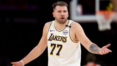 直接差异 直接差异